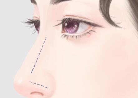 北京協(xié)和醫(yī)院龍飛隆鼻怎么樣？分享專家資料，含坐診醫(yī)院簡(jiǎn)介