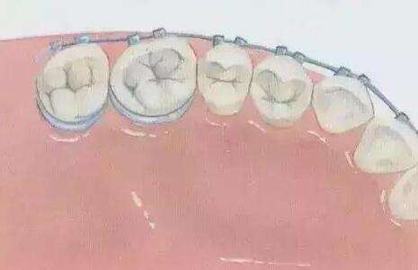 中山人民醫(yī)院牙齒矯正怎么樣？分享科室資料、坐診醫(yī)生推薦