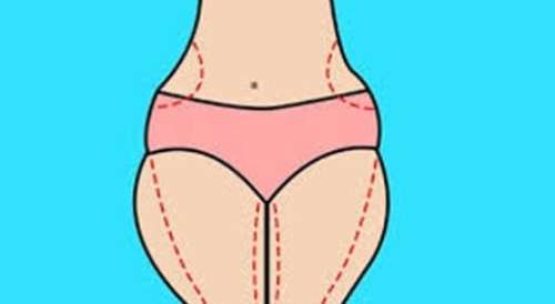 廣州美貝爾大腿吸脂的女人日記 分享！來看看前后差別大不大吧