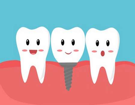 長沙中諾口腔種植牙價格表一覽？種植牙價格為5000元起