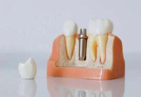 邵逸夫醫(yī)院種植牙怎么樣？匯總技術(shù)實力如何？含醫(yī)生信息