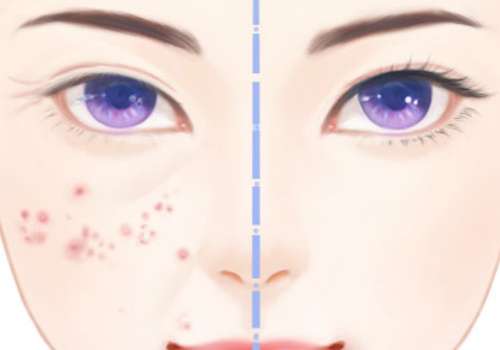 廣東省中醫(yī)院光子嫩膚價格是多少?醫(yī)院信息及價格表更新