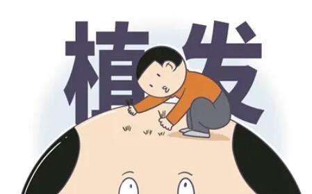 植發(fā) 植發(fā)