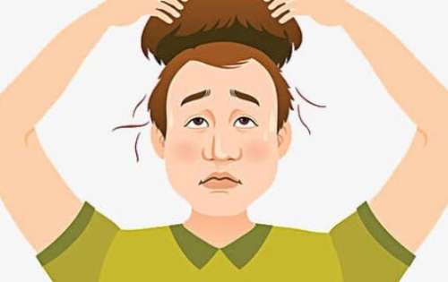 植發(fā) 植發(fā)