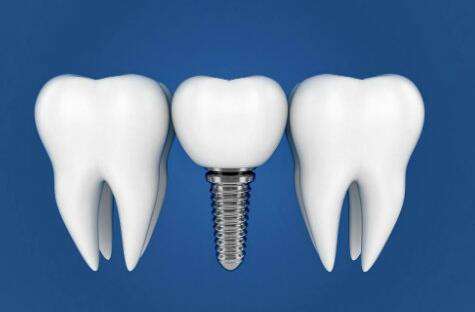 上海億大口腔種植牙怎么樣？附有熱門(mén)醫(yī)生資料，含網(wǎng)友評(píng)價(jià)