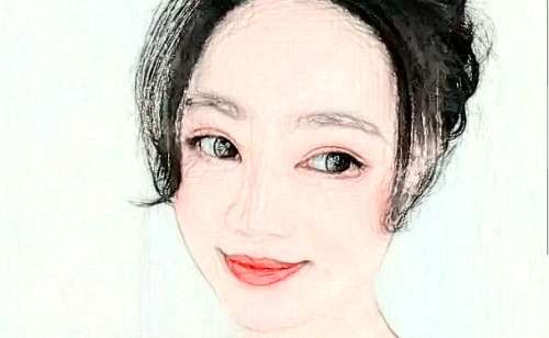 武漢市第三醫(yī)院面部下垂提升90天恢復(fù)案例(效果怎么樣?技術(shù)特點(diǎn))