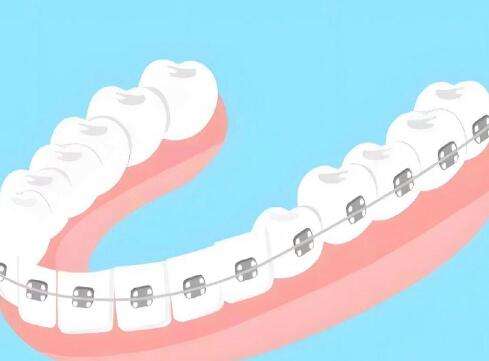 寧波第一醫(yī)院牙齒矯正掛什么科？附科室信息、口碑如何？