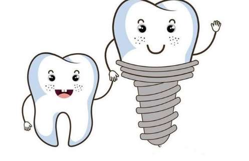 沈陽種牙價格一般多少錢？價格比較合適，是從2000多元起