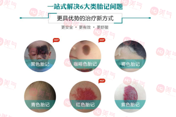 手術(shù)去胎記