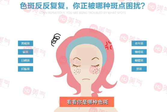 化學(xué)剝脫祛斑