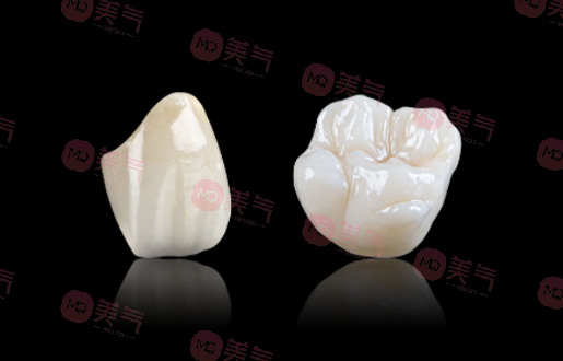 廣州全瓷牙價格多少？2023費用明細(xì)-全瓷牙優(yōu)勢、注意事項附上