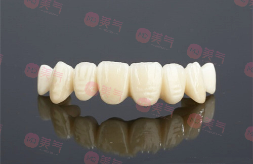 鎳鉻烤瓷牙和鈷鉻烤瓷牙哪個好，烤瓷牙修復優(yōu)缺點有哪些？