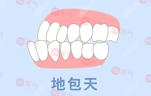 地包天矯正需要多少費(fèi)用？骨性地包天整形費(fèi)用2-4萬(wàn)起