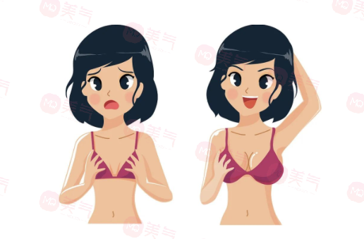 深圳美萊隆胸僅需8770元起！技術(shù)優(yōu)勢(shì)和整友反饋勸你快來