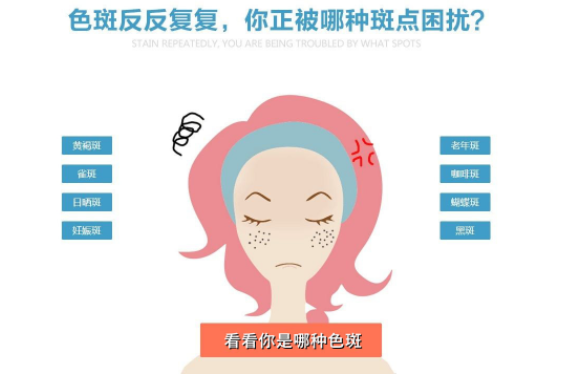 祛斑
