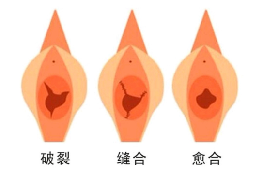 處女摸修復(fù)